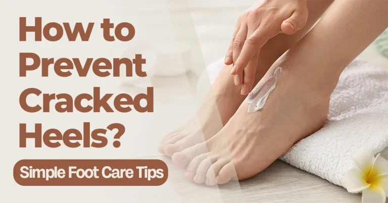 How to prevent cracked heels with simple daily foot care and moisturizing